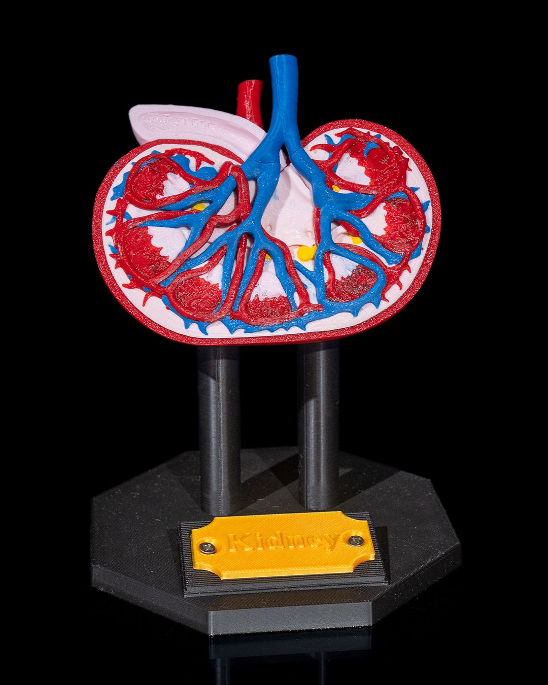 Kidney Anatomical Model - Image 2