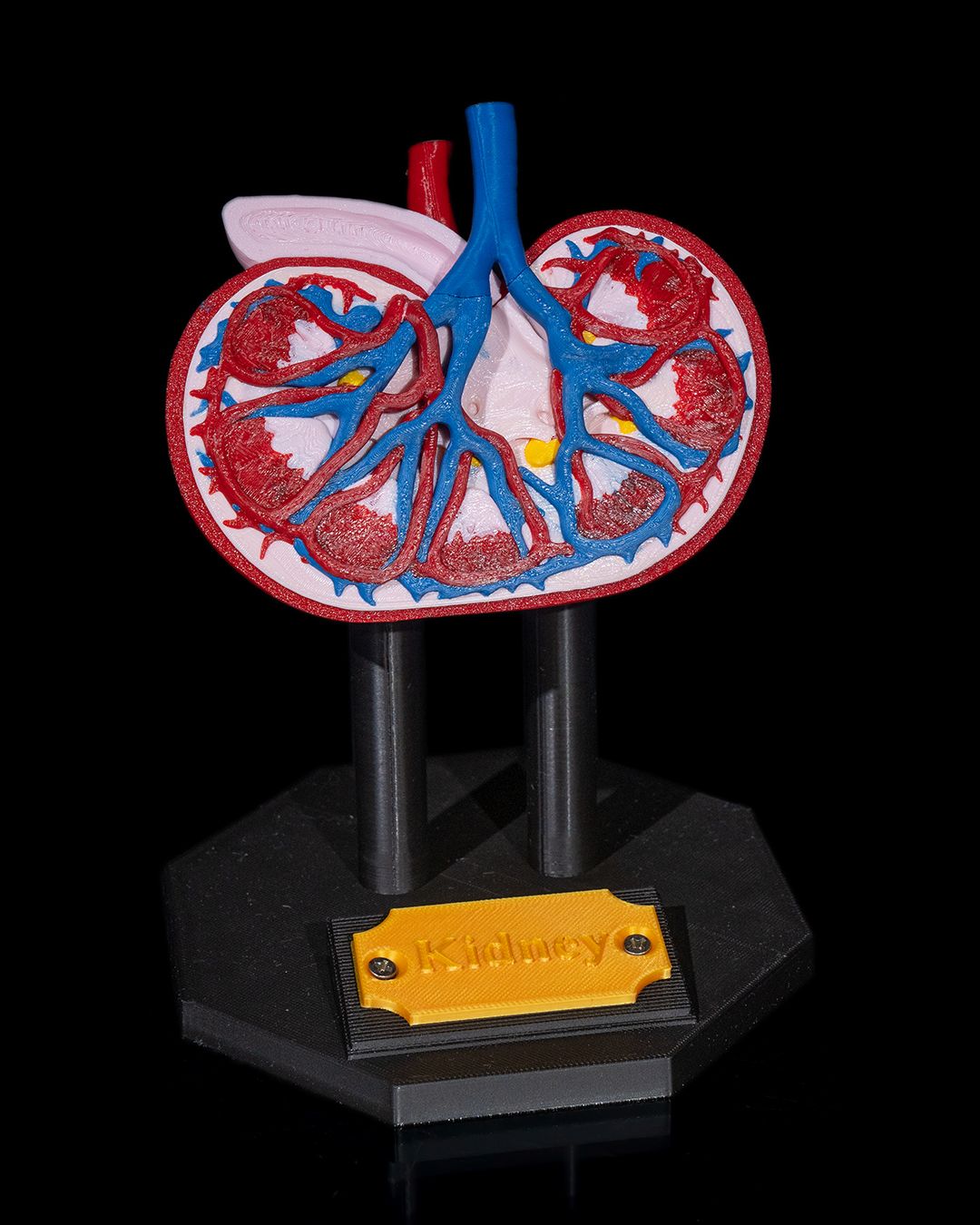 Kidney Anatomical Model - Image 6